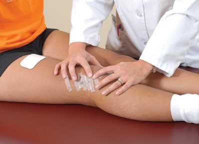 patellar mobilization