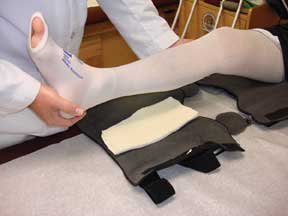 bi-valved cylinder cast