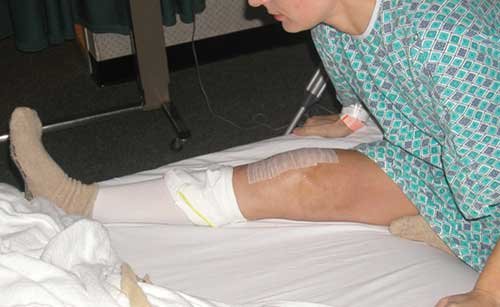 overpressure extension