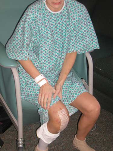 flexion overpressure