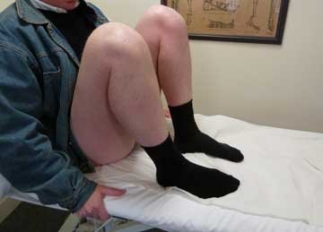 twelve weeks after osteotomy