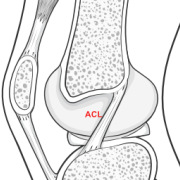 ACL - knee cut in half