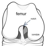 notch