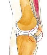 arthrofibrosis02.jpg