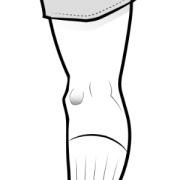 Baker's cyst forming a painful lump at the back of the knee