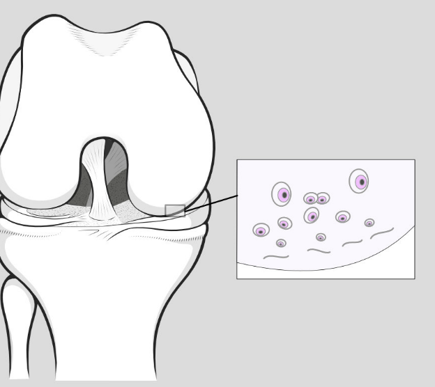 inset showing articular cartilage of knee