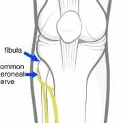 common peroneal nerve