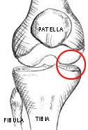 Illustration of medial compartment