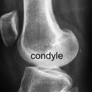 rounded condyles of femur