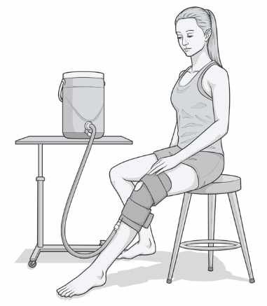 Cryotherapy icing system
