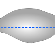 cut for patellar button