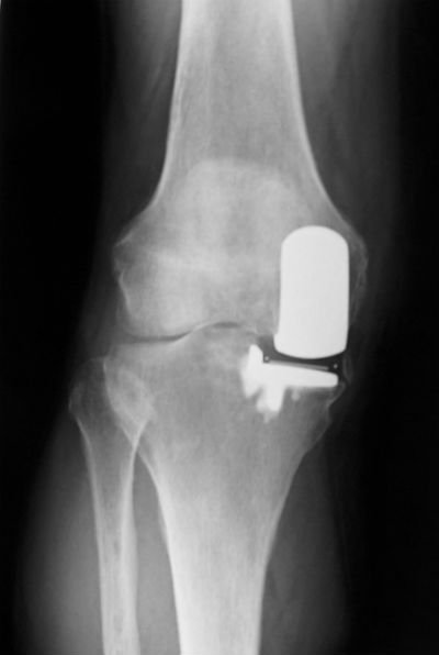 depositphotos_8411264_cropped.jpg
