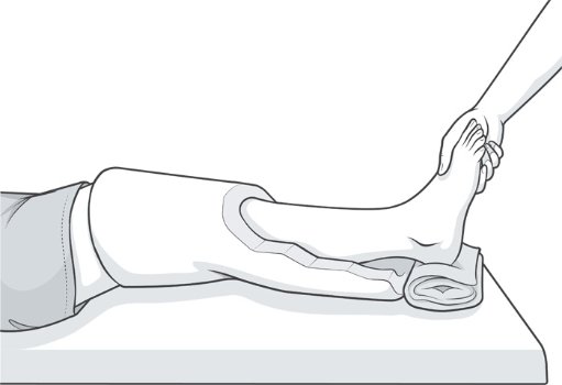 drop-out cast to improve extension