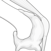 effusion of knee contained within joint capsule