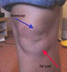 fat pad