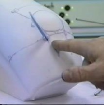 arthroscopy portala