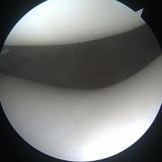 hyaline cartilage