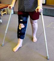 immobiliser brace