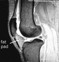 fat pad