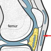 infrapatellar bursa