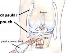capsular pouch of knee