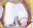 rounded condyle of femur