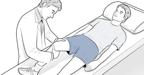 Illustration of surgeon performing the Lachman test on a patient.