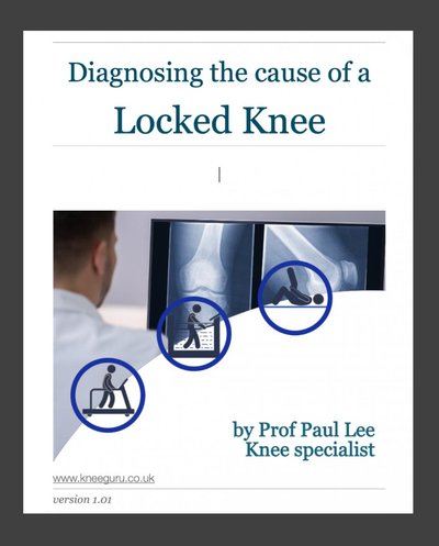 locked-knee_framed