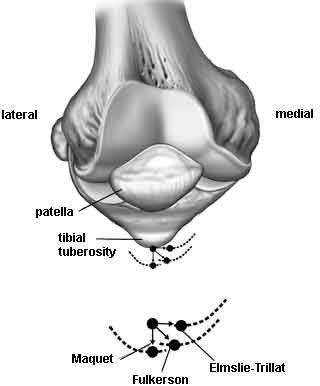 maquet