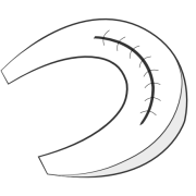 meniscal repair with sutures