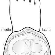 menisci on top of tibial plateau