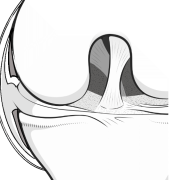 knee meniscus showing the menisco-capsular junction