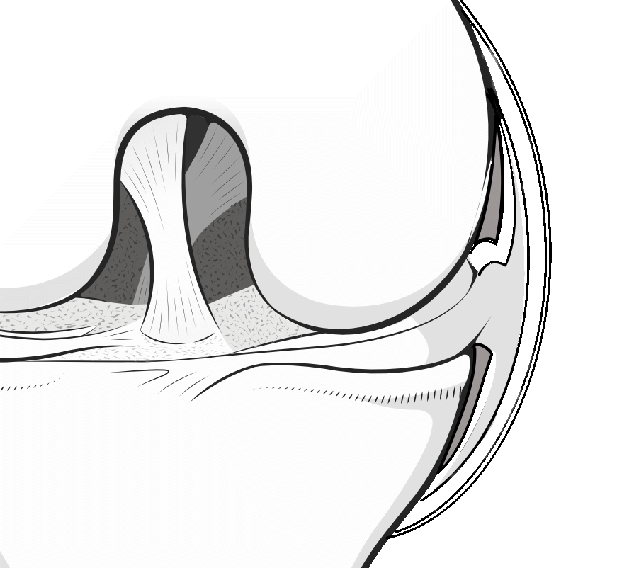 knee meniscus showing the menisco-capsular junction