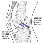 meniscofemoral ligament