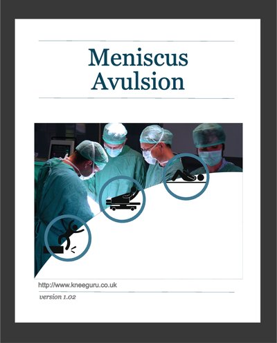 Meniscus Avulsion - Ebook cover