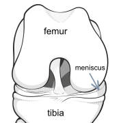 meniscus shock absorber