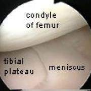 close up of condyle