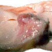 donor menisci ready to be prepared for transplant
