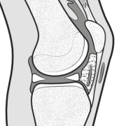 normal infrapatellar area