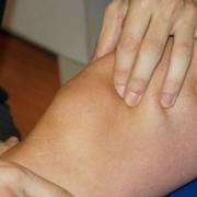 patellar mobilisations