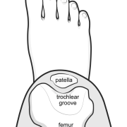 patella located within the walls of the trochlear groove