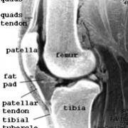 fat pad