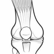 patellar tendon rupture