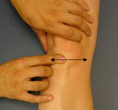 patellar tendon glide