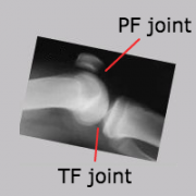patellofemoral and tibiofemoral joints