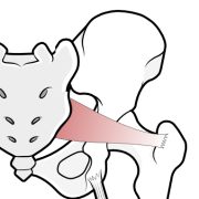 piriformis muscle