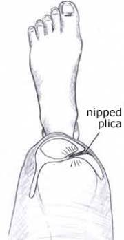 plica07.jpg