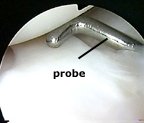 probing the meniscus