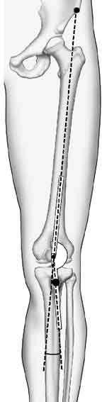 q-angle