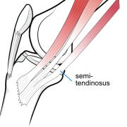 semitendinosus